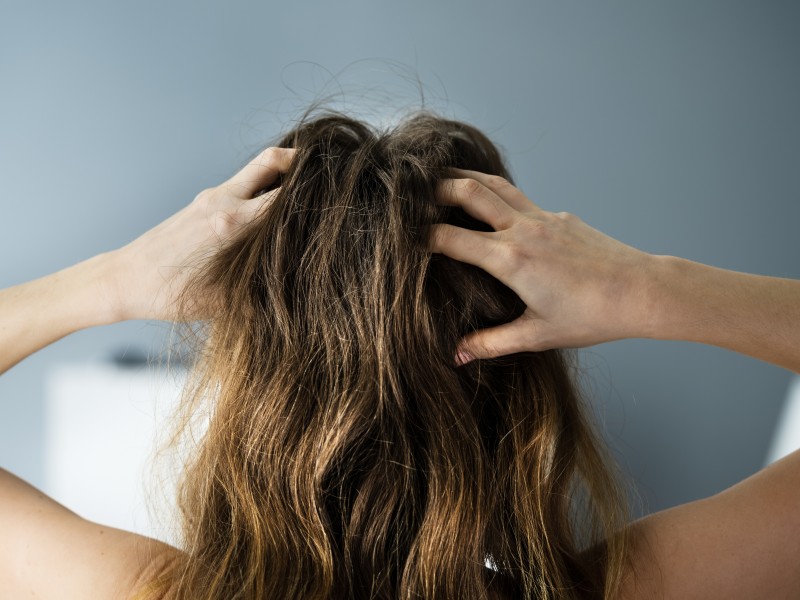 co-wplywa-na-suchosc-wlosow-w-zimie-i-jak-temu-zaradzic