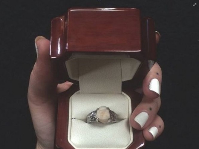 pierscionek-zareczynowy-wykonany-z-zeba-madrosci-narzeczonego